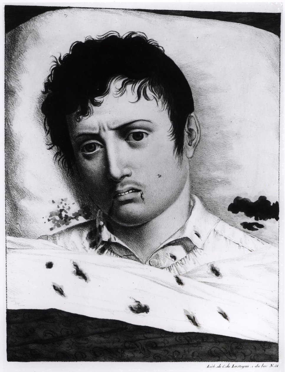 Observatie van gele koorts, c.1819 door Charles Lasteyrie du Saillant