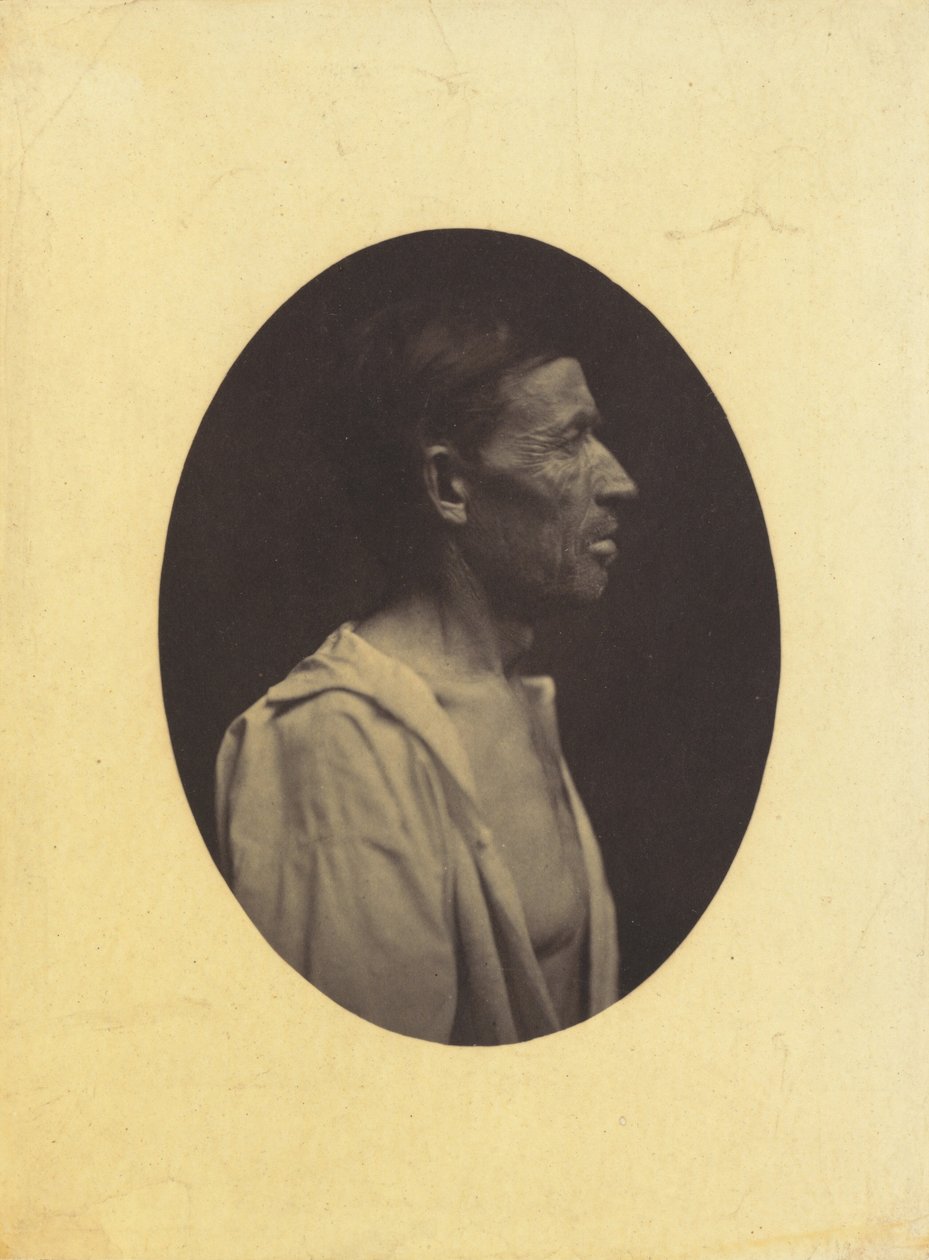 Een portret, in profiel gezien, van een man van 42 jaar, verdoofd door alcoholmisbruik..., 1854-1856 door Duchenne de Boulogne