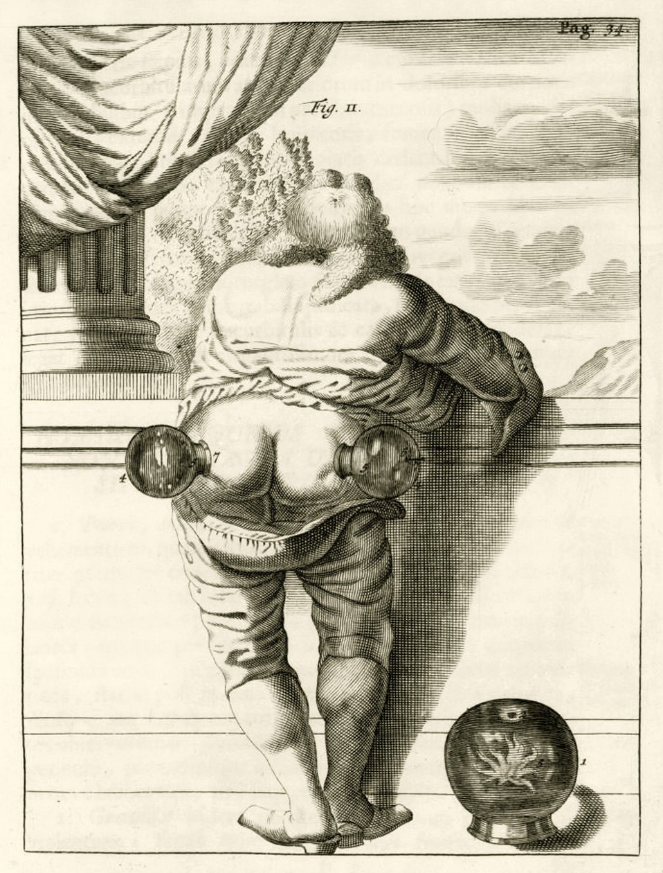 Een voorbeeld van koppen, uit Exercitationes Practicae circa Medendi Methodum door Frederik Dekkers, 1694 door Dutch School