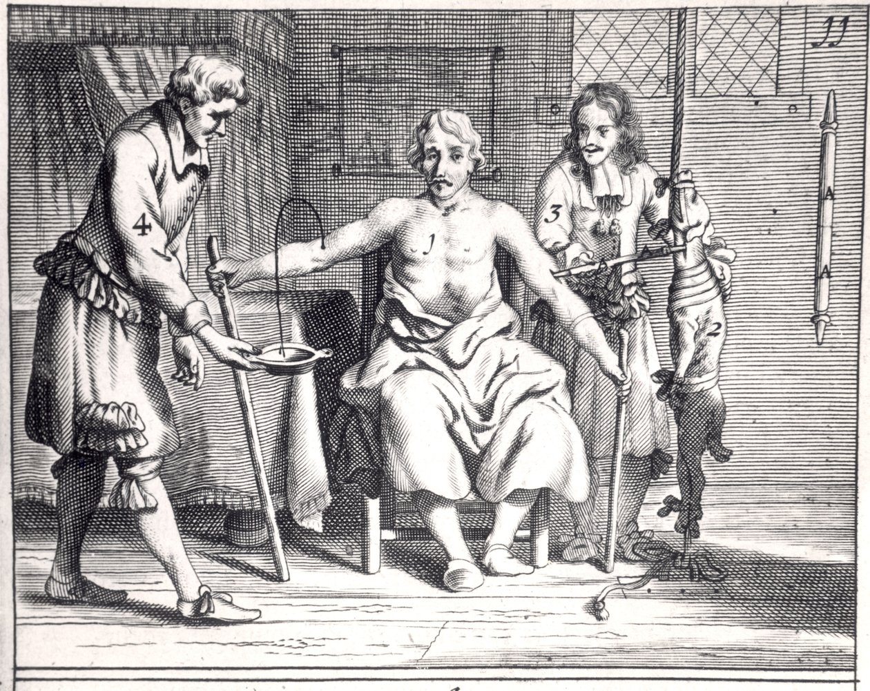 Bloedtransfusie van een hond, uit Armamentarii Chirurgici door Johannes Schultes (1595-1645) gepubliceerd in Amsterdam, 1671 door Dutch School