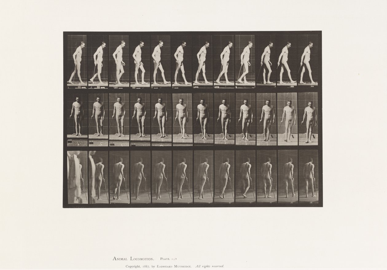 Plaat 559. Gedissemineerde Sclerose; Lopen met Stok door Eadweard Muybridge