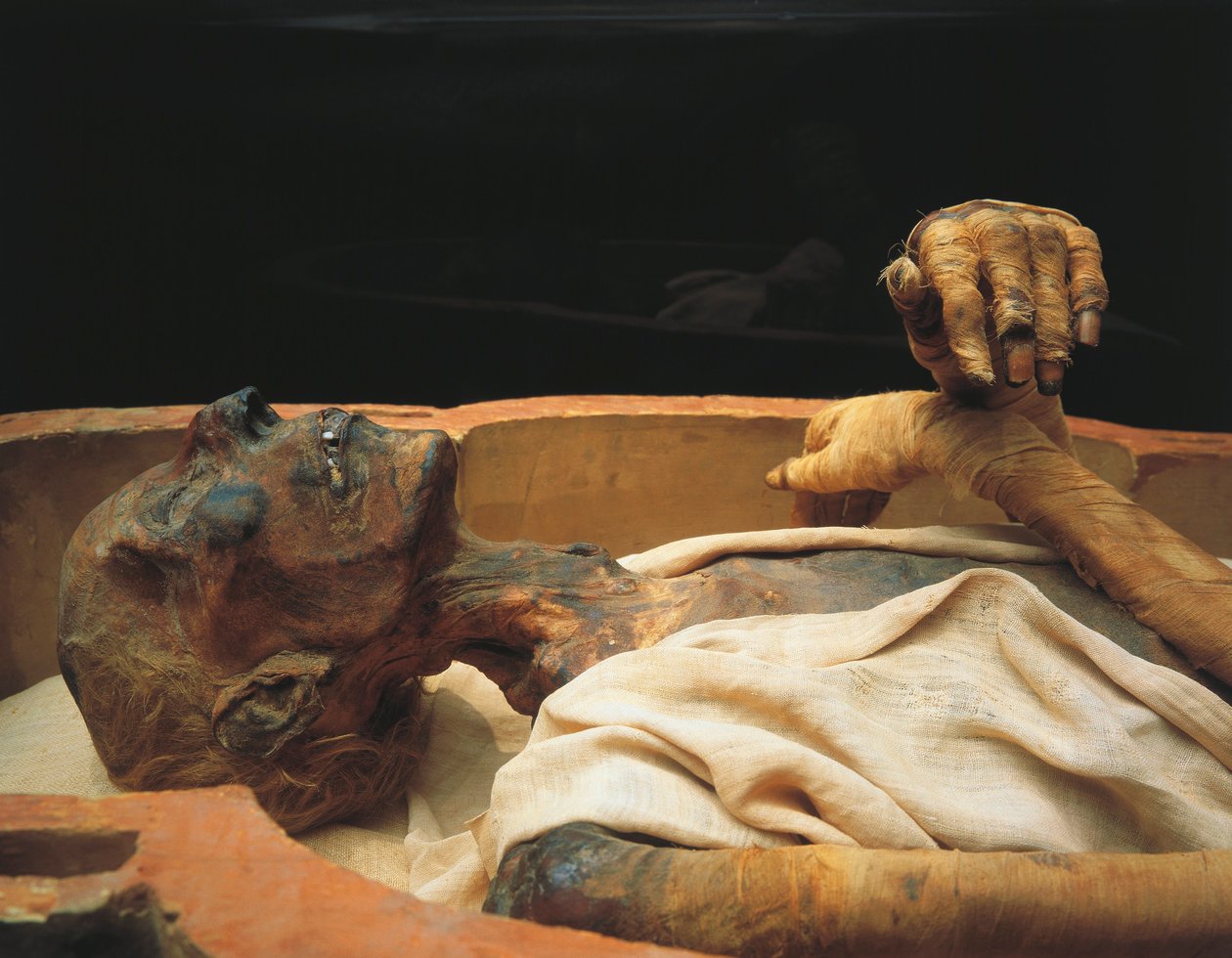 Mummie van Ramses II, detail | Egyptian 19th Dynasty