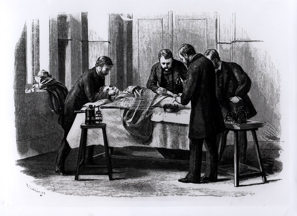 Antiseptische chirurgie, 1882 door English School