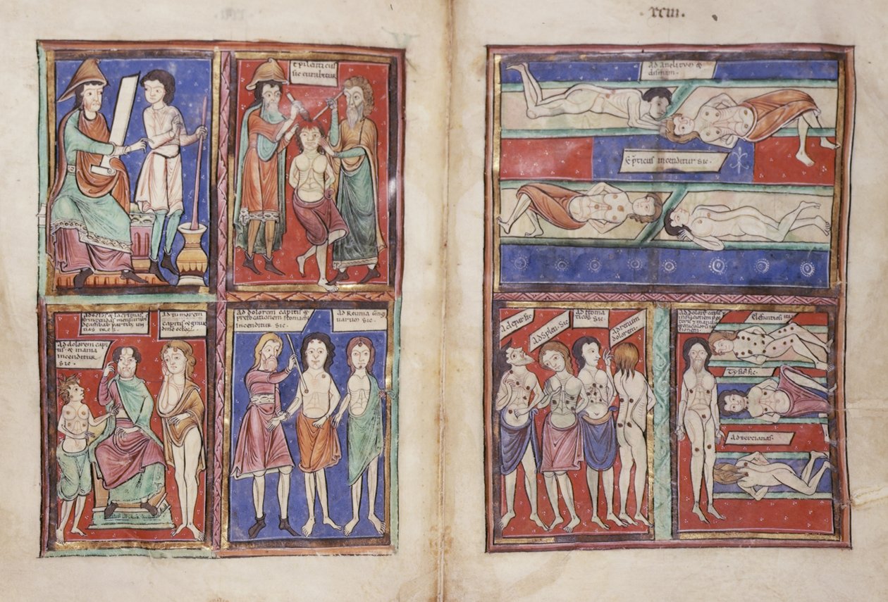 Sloane 1975 fol.91v-92 Medische scènes door English School