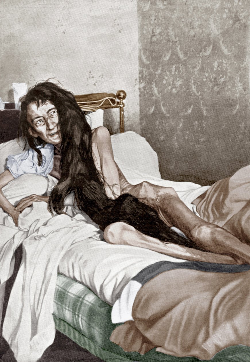 Blanche Monnier in het ziekenhuis, Poitiers, juni 1901 (afdruk) door French School