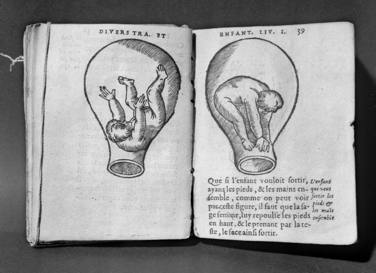 Foetus in de baarmoeder, illustratie uit het zogenaamde Rhodion-manuscript door French School