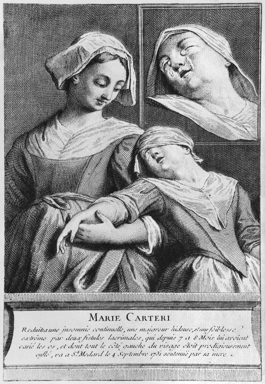 Wonderbaarlijke genezing van een blinde vrouw, Marie Carteri, op het graf van Diaken François de Paris op de parochiebegraafplaats Saint-Médard in Parijs door French School