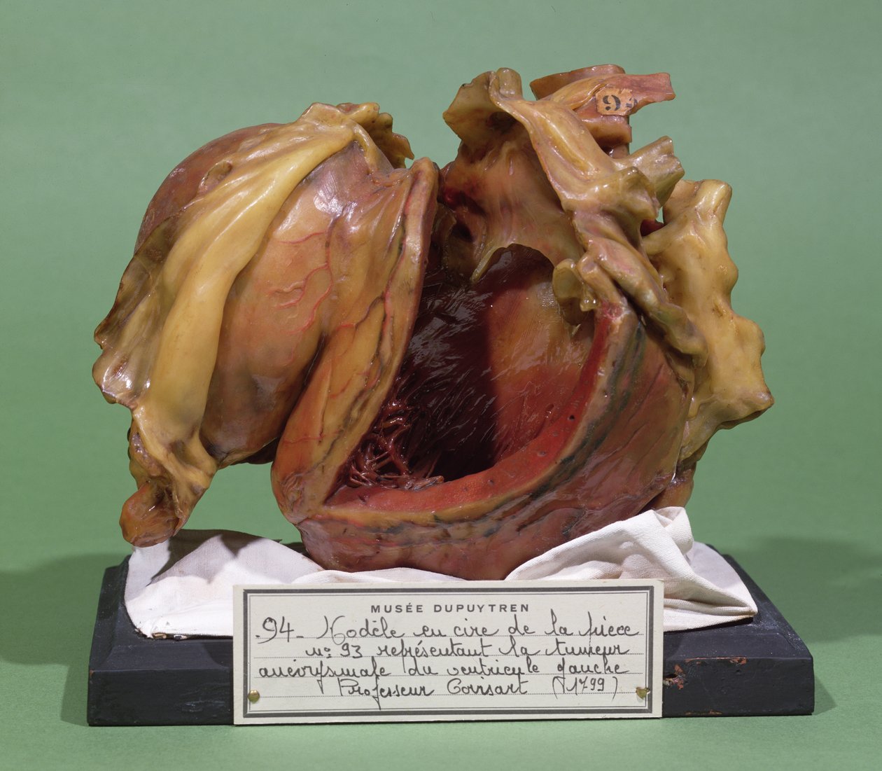 Model van een tumor van de linker hartkamer, 1799 (was) door French School