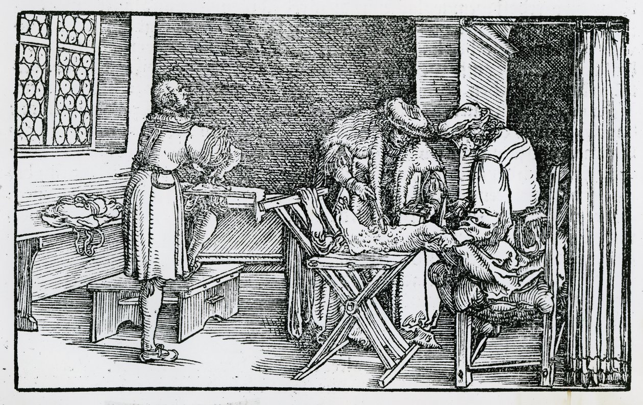 De behandeling van een gangreneus been door German School