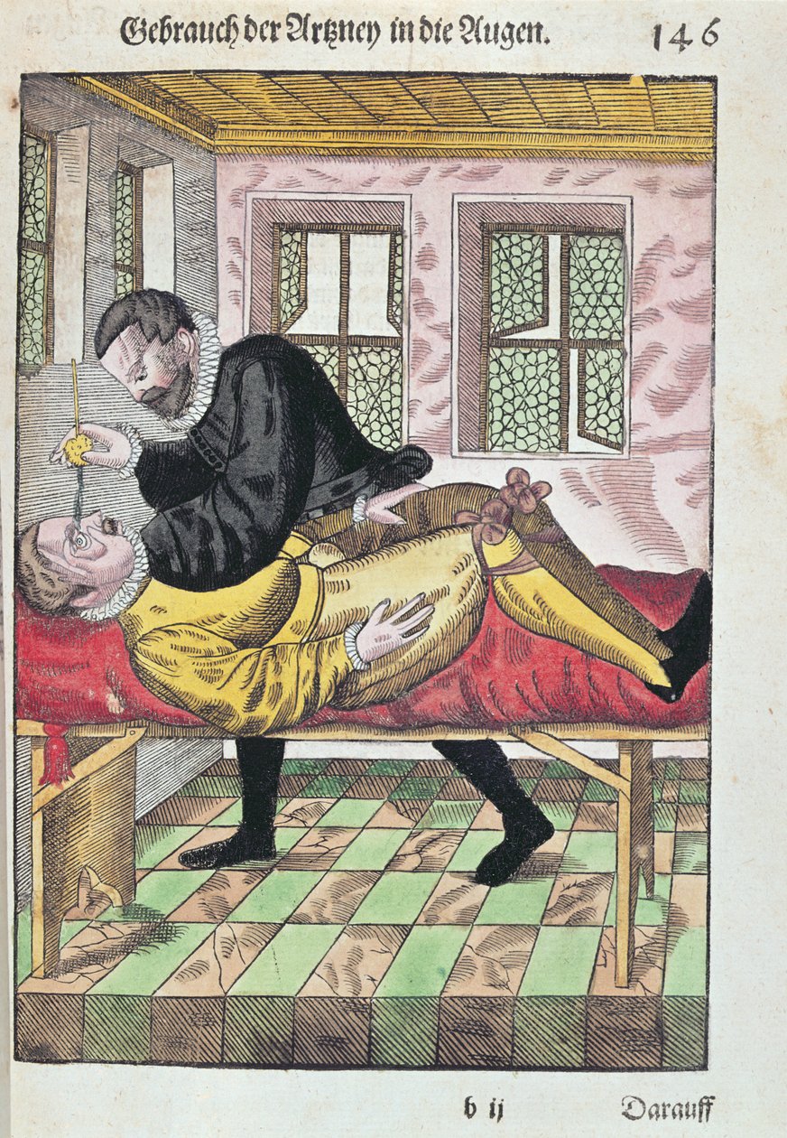 Oogoperatie, uit Ophthalmodouleia door Georg Bartisch gepubliceerd in Dresden in 1583 door German School