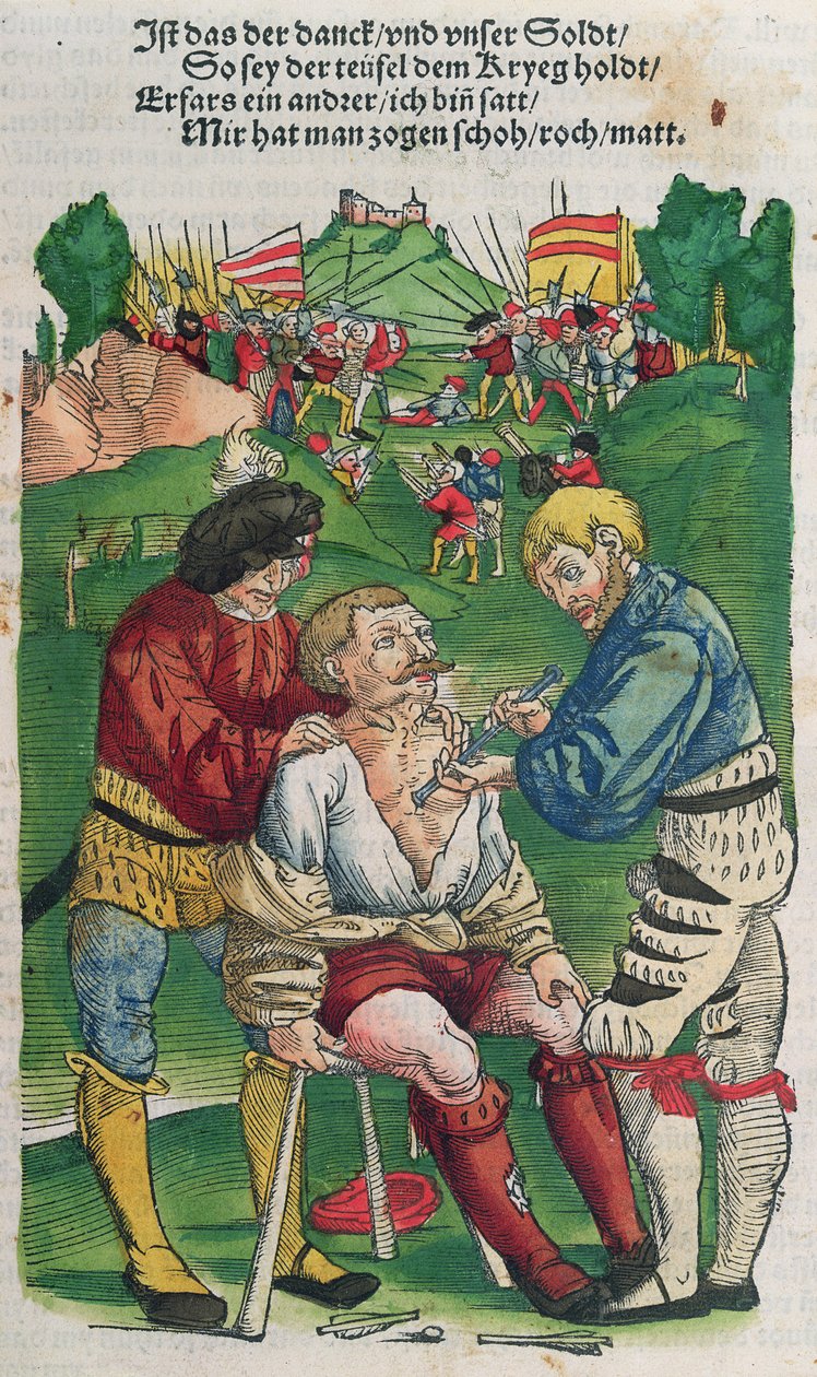 Een pijl verwijderen, illustratie uit Feldtbuch der Wundartzney door Hans von Gersdorff, 1540 door German School