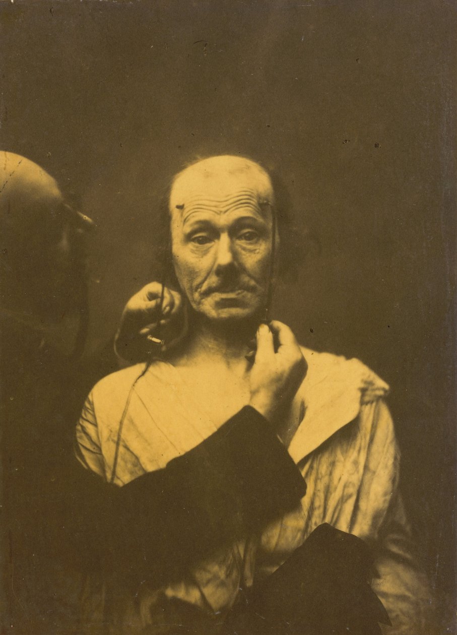 Aandacht,1854-1856, gedrukt 1862 (foto) door Guillaume Benjamin Armand Duchenne de Boulogne