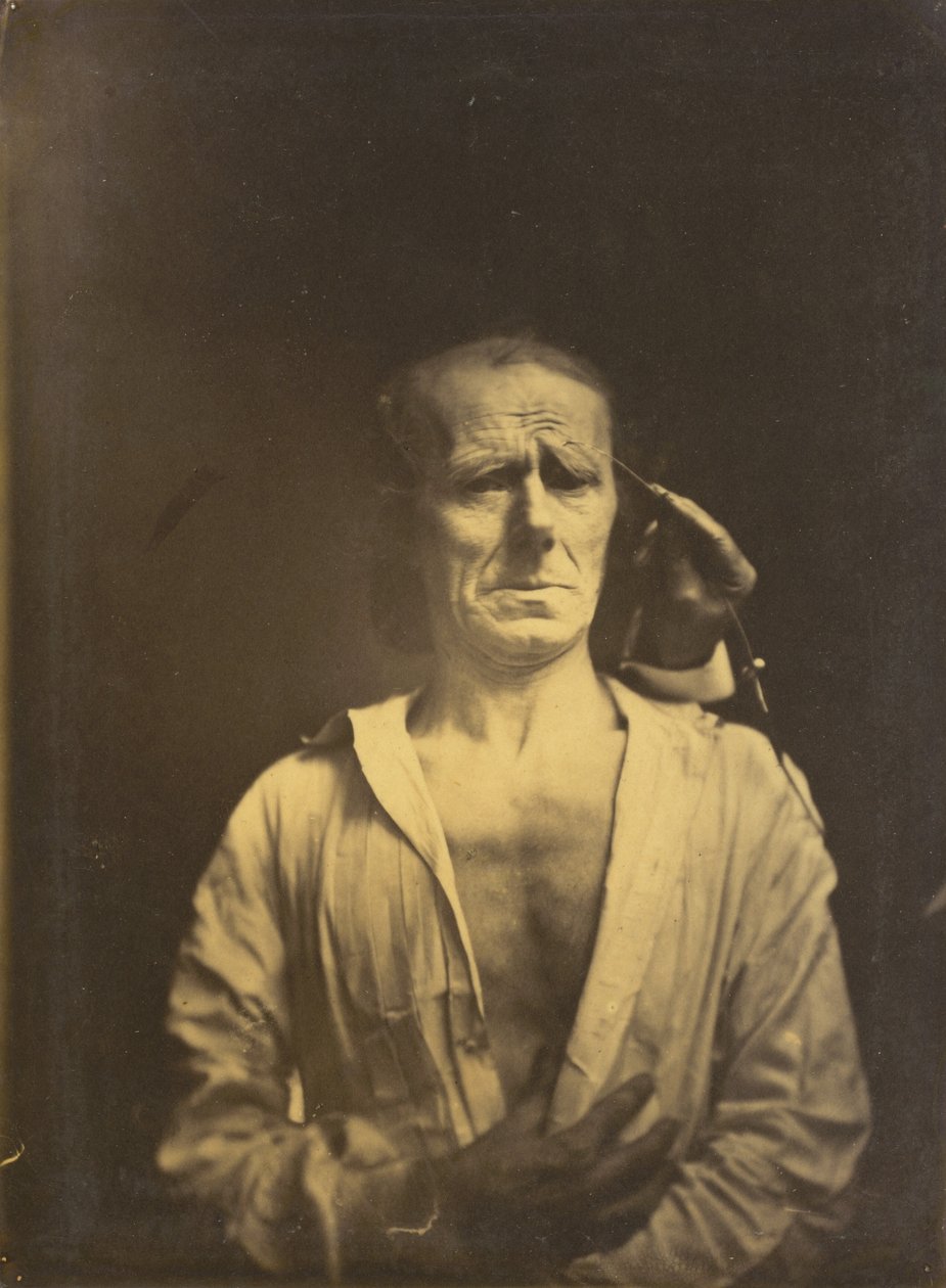 Spasme van m. corrugator supercilii onder zeer sterk licht (links); Een ontspannen gezicht (gefotografeerd in volle zon) (rechts) door Guillaume Benjamin Amant Duchenne