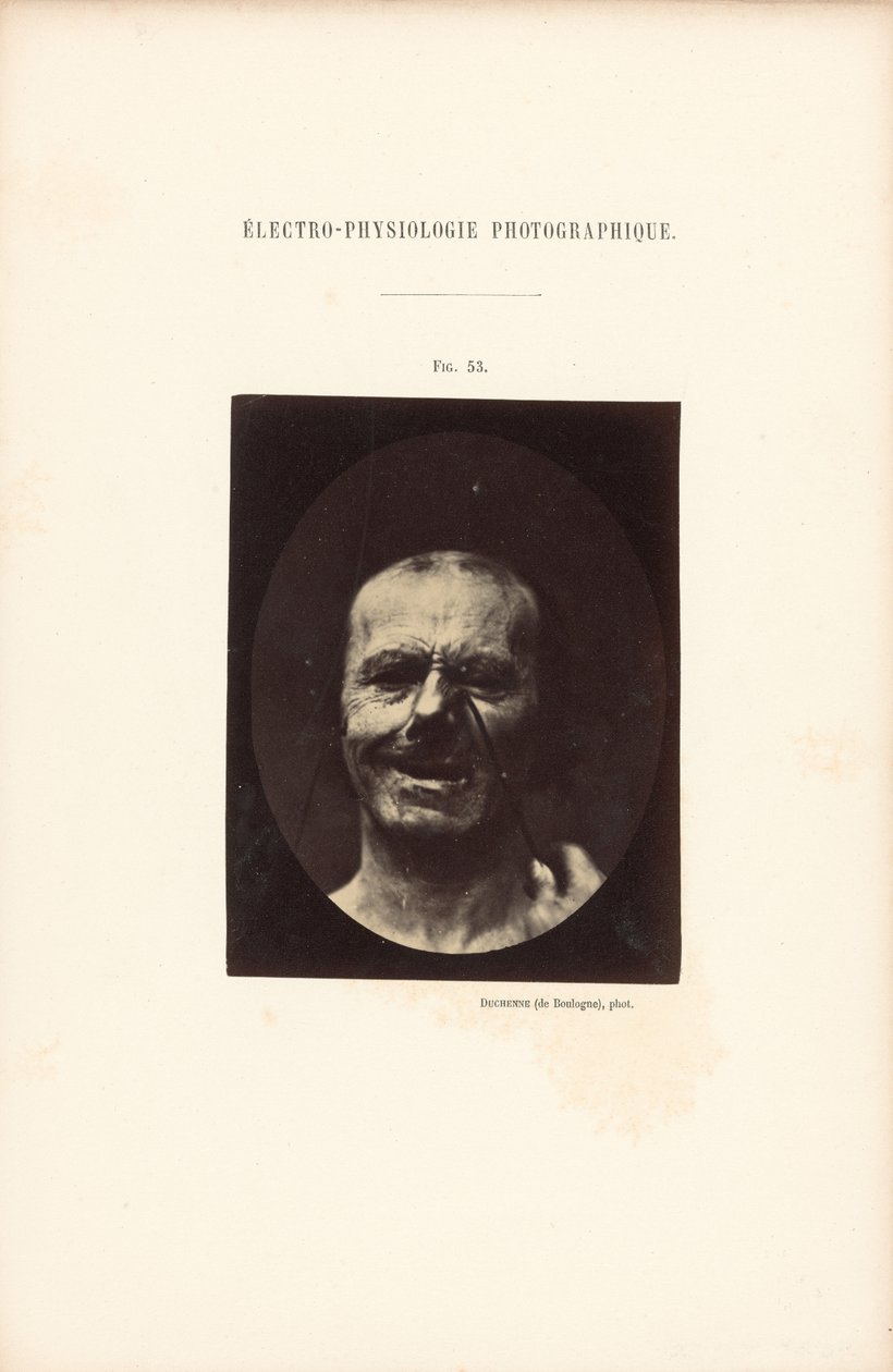 Fotografische elektrofysiologie, Afbeelding 53 door Guillaume Benjamin Duchenne