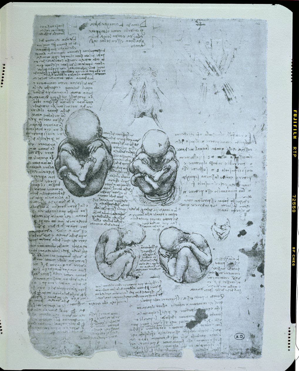 Vijf Zichten van een Foetus in de Baarmoeder, facsimile kopie door Leonardo da Vinci