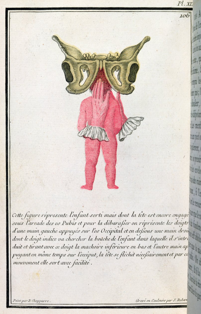 Dwarsdoorsnede van een baby uit de baarmoeder, uit een boek van Madame Angelique Le Boursier du Coudray, gegraveerd door J. Robert, 1783 door P. Chapparre