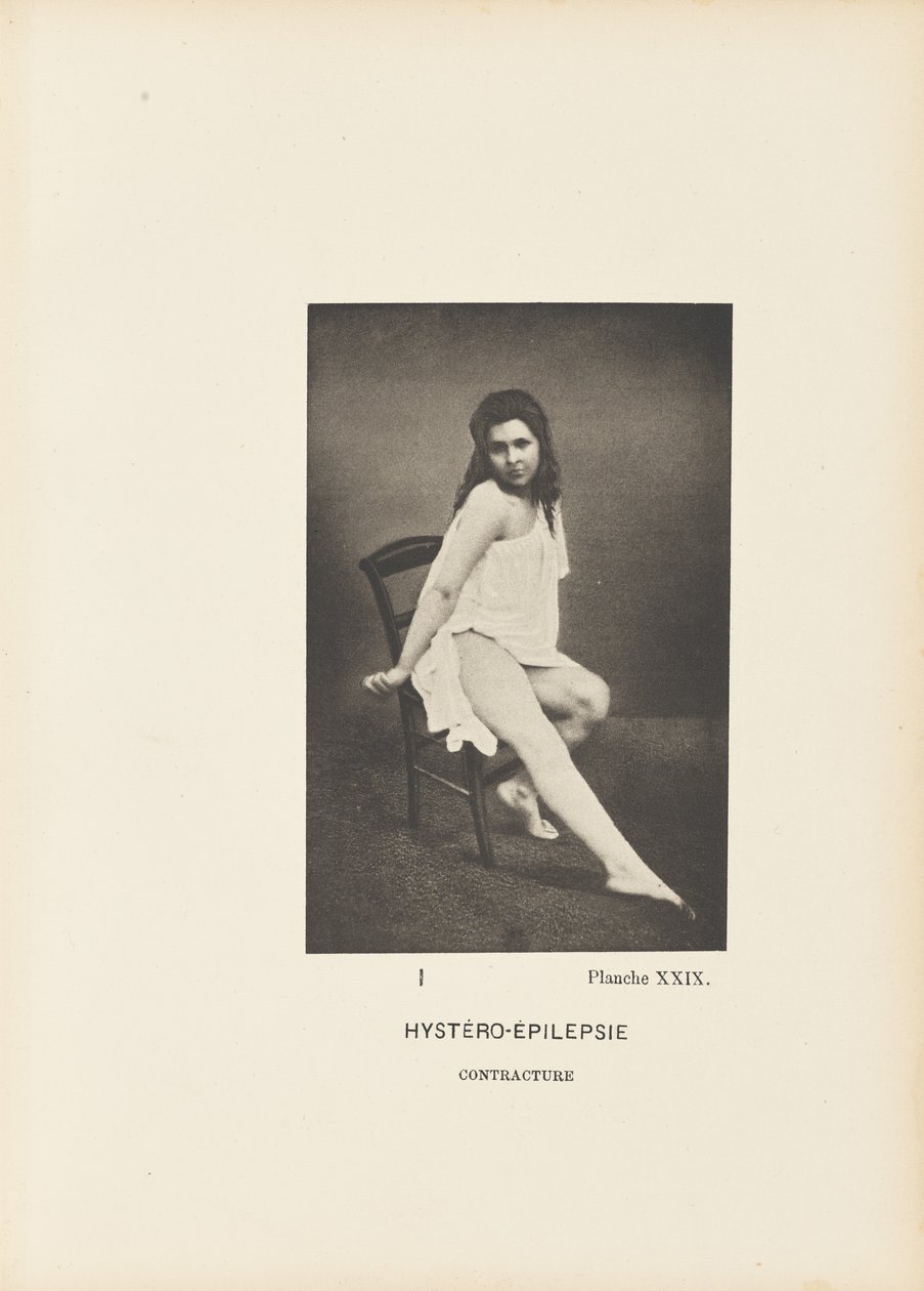 Hystero-epilepsie contractuur door Paul Marie Léon Regnard