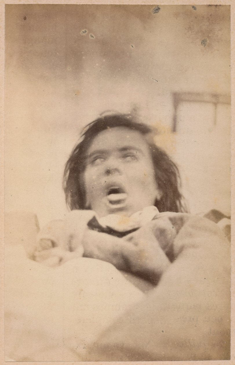Hysterische epilepsie, hallucinaties, angst, plaat XXIX uit 