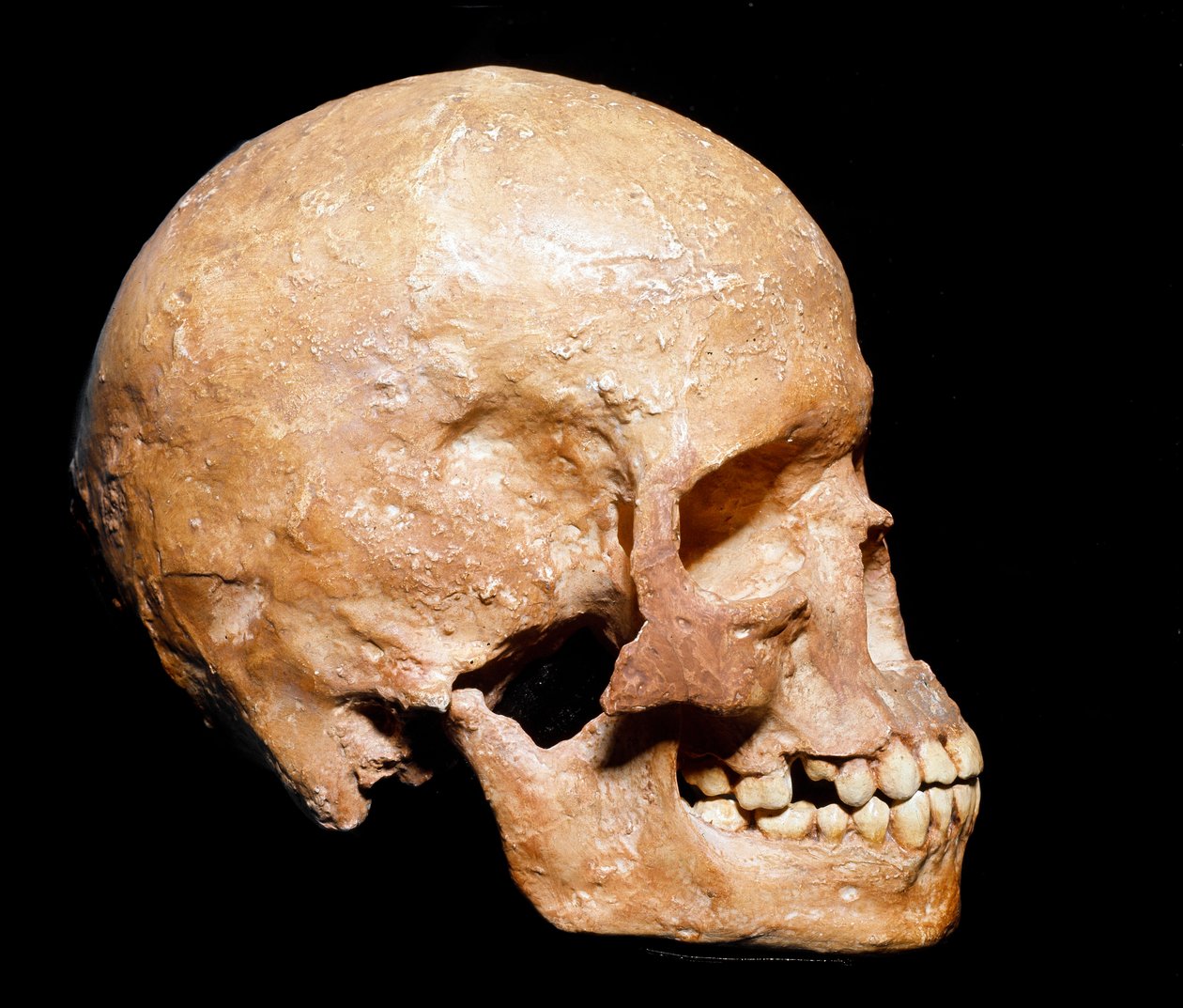 Prehistorie: fossiele schedel van Homo sapiens uit Grimaldi. Cultuur van het Aurignacien, boven-paleolithicum door Prehistoric Prehistoric