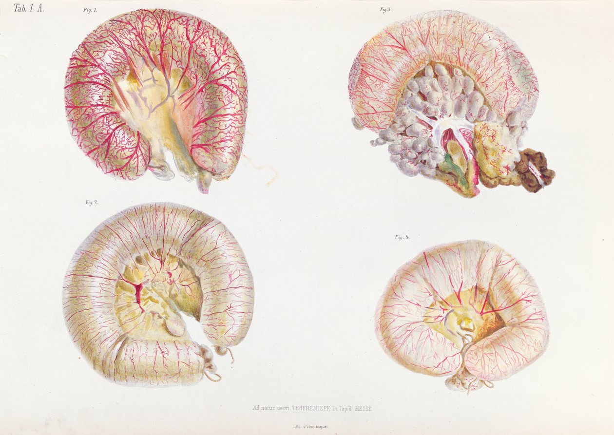 Het externe oppervlak van de darmen geïnfecteerd met cholera, uit Anatomie Pathologique du Cholera Morbus, door Nikolai Ivanovich Pirogov, gepubliceerd in St. Petersburg, 1849 door Russian School