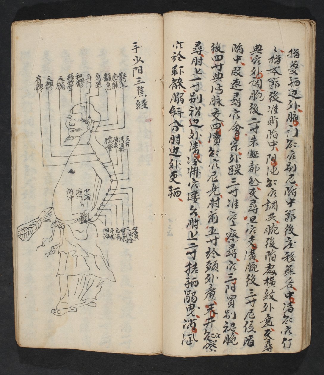 Acupunctuurpunten op de arm, nek en basis van het hoofd, uit Jing Guan Qi Zhi, 