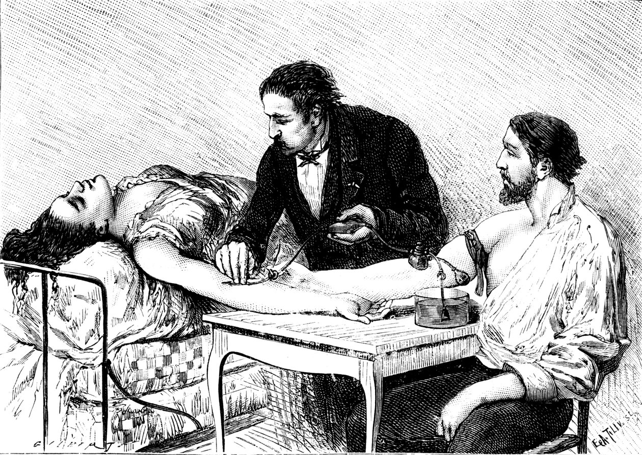 Dr. Roussell uit Genève geeft een vrouw een directe bloedtransfusie van een vrijwilliger, 1882 door Unbekannt
