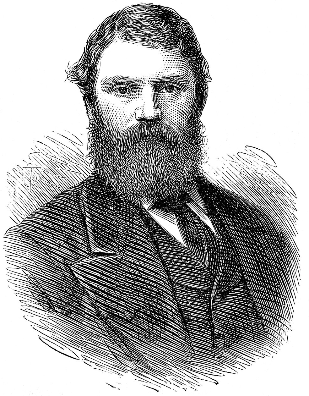 Francis Edmund Anstie 1833-1874, Engelse arts, 1874 door Unbekannt