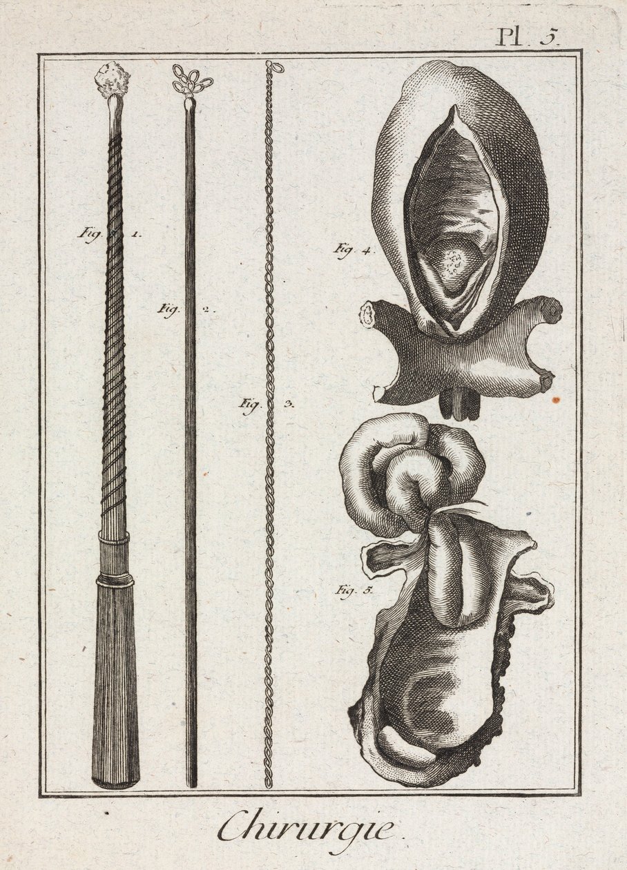 Uitrusting, vroegmoderne chirurgische instrumenten en diagrammen van lichaamsdelen door Unbekannt
