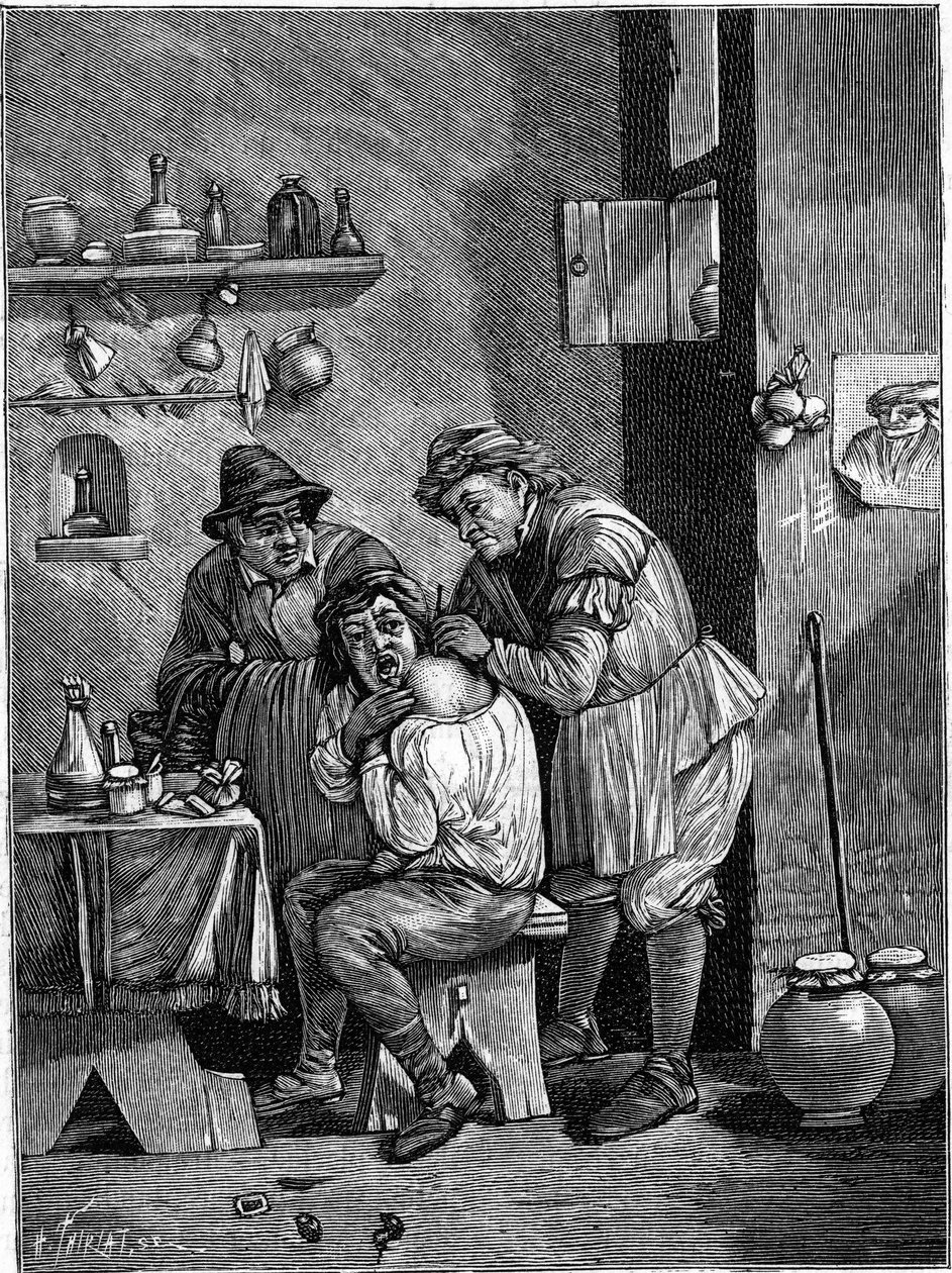 Een kwakzalverchirurg in de 18e eeuw onderzoekt een schouderblessure. (Van een gravure uit die tijd). Gravure in 