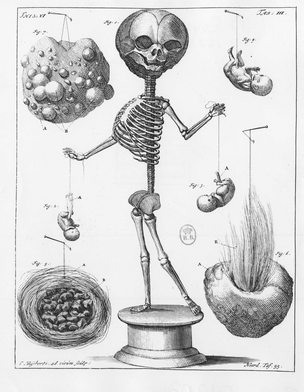 Anatomische plaat die een skelet voorstelt, door Frederik Ruysch (1638-1731), Nederlandse anatoom door Unknown artist