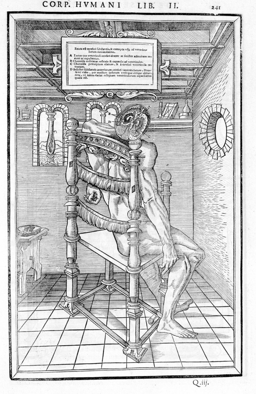 Schedelsnede. Anatomische plaat van 