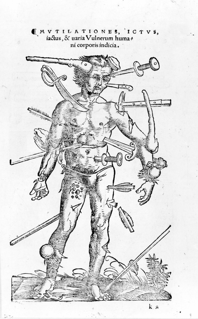Alle soorten traumatische oorlogsverwondingen. 16e eeuw door Unknown artist