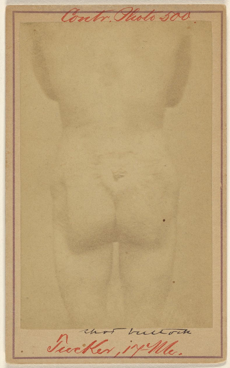 [Jno. E. Tucker, in de billen geschoten, slachtoffer burgeroorlog]. door Unknown artist