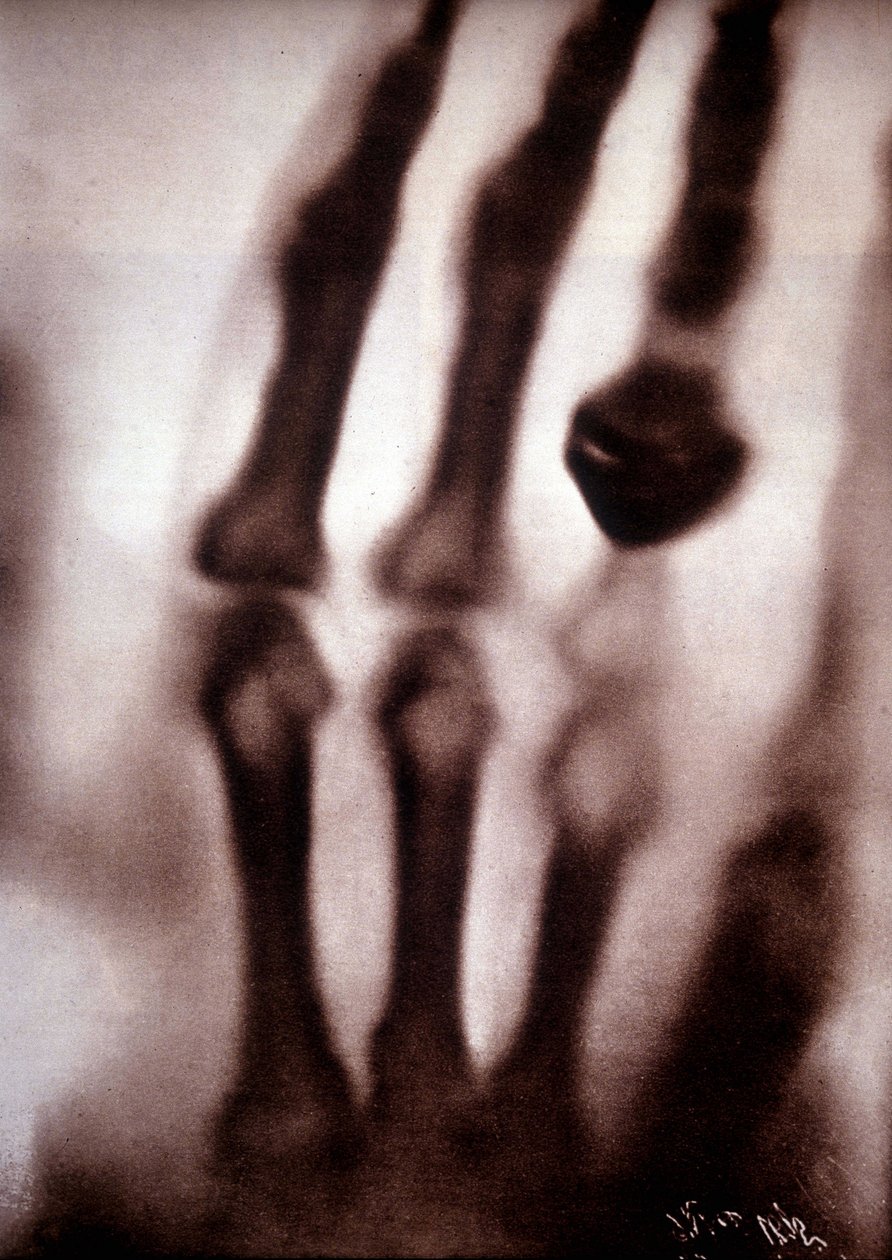 Röntgenstralen of X-stralen Eerste foto: de hand van de vrouw van Röntgen. 22/12/1895. door Unknown artist