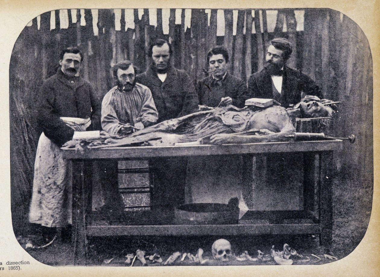 Dissectie, ca. 1865. door Unknown photographer