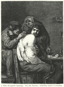 De Rugoperatie door Adriaen (after) Brouwer