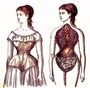 Korsetcompressie - Normaal leven en gezondheid door J. Rengade. Tekening door A. Demarle 1881 door Alphonse Demarle