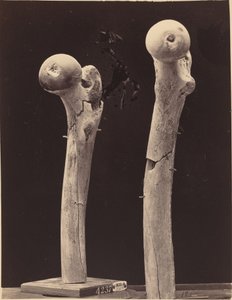 Specimens van Schotwonden aan het Dijbeen door American 19th Century