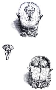De platen uit het zevende boek van de De Humani Corporis Fabrica door Andreas Vesalius