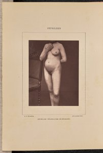Gegeneraliseerde vesiculaire syfilis
