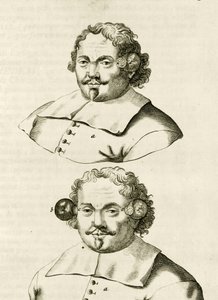 Een voorbeeld van koppen, uit Exercitationes Practicae circa Medendi Methodum door Frederik Dekkers, 1694 door Dutch School