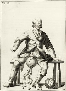 Aftappen van vocht uit een hydrocele van het scrotum, uit Exercitationes Practicae circa Medendi Methodum door Frederik Dekkers, 1694 door Dutch School