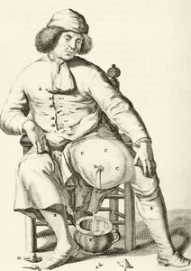 Aftappen van vocht uit een abces, uit Exercitationes Practicae circa Medendi Methodum door Frederik Dekkers, 1694 door Dutch School