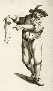 Verwijderen van dode huid met puisten, uit Exercitationes Practicae circa Medendi Methodum door Frederik Dekkers, 1694 door Dutch School