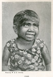 Krao, De Missing Link, tentoongesteld in het Aquarium, Westminster, Londen, in 1887