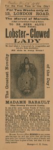 Advertentie voor een optreden van Madame Babault, de kreeftklauw dame door English School