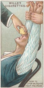 Hoe een bloedneus te stoppen, nr.31 uit de Eerste Hulp-serie van Willss Cigarettes kaarten door English School