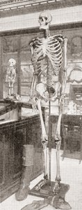 De skeletten van Charles Byrne door English School