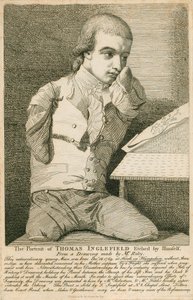Thomas Inglefield, geboren 18 december 1769 in Hook, Hampshire, zonder armen of benen door English School