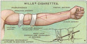 Tourniquet, nr.11 uit de Eerste Hulp-serie van Willss Cigarettes kaarten